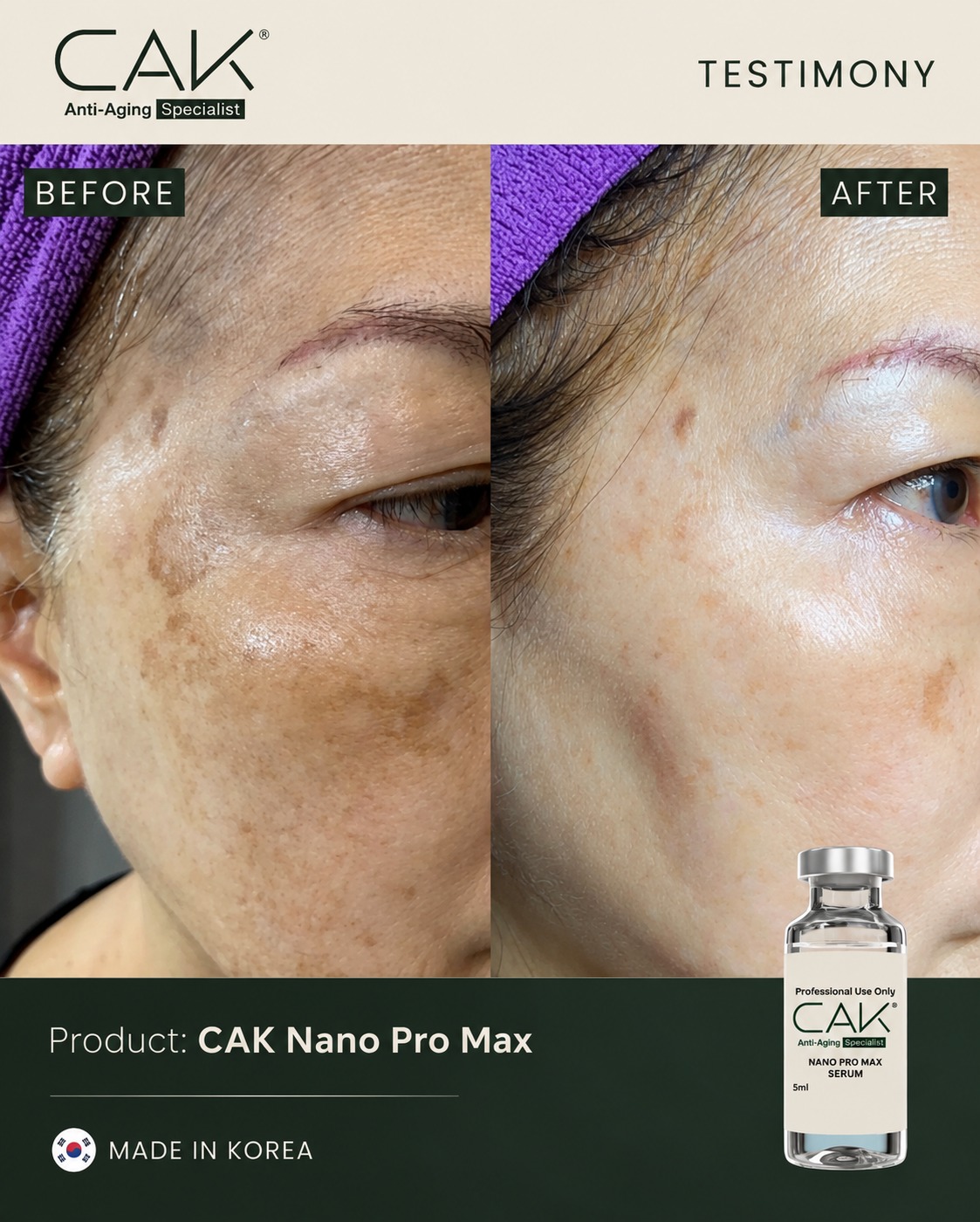 CAK Stem Cell Treatment before and after